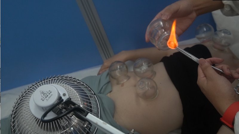 针灸推拿
